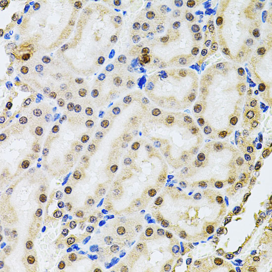 POP4 Rabbit Polyclonal Antibody - Image 2