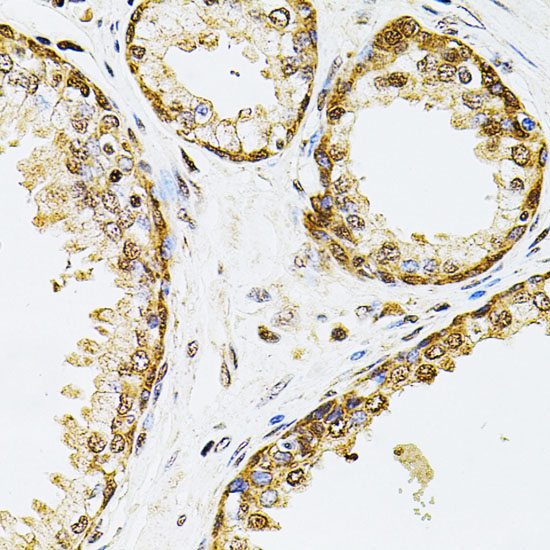 POP4 Rabbit Polyclonal Antibody - Image 3