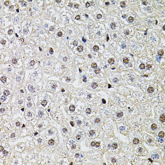 POP4 Rabbit Polyclonal Antibody - Image 4