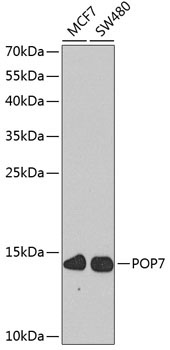 POP7 Rabbit Polyclonal Antibody