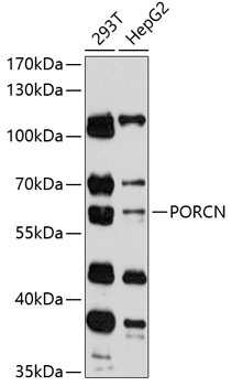 PORCN Rabbit Polyclonal Antibody