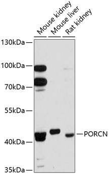 PORCN Rabbit Polyclonal Antibody