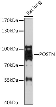 POSTN Rabbit Polyclonal Antibody