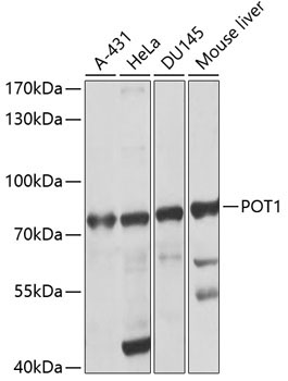 POT1 Rabbit Polyclonal Antibody