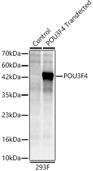 POU3F4 Rabbit Polyclonal Antibody
