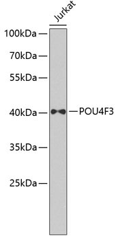 POU4F3 Rabbit Polyclonal Antibody