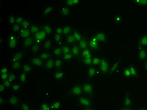 POU6F1 Rabbit Polyclonal Antibody - Image 2