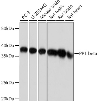 PP1 beta Rabbit Monoclonal Antibody