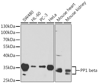 PP1 beta Rabbit Polyclonal Antibody
