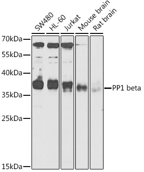 PP1 beta Rabbit Polyclonal Antibody