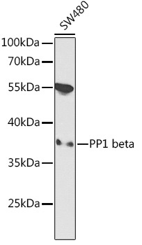 PP1 beta Rabbit Polyclonal Antibody