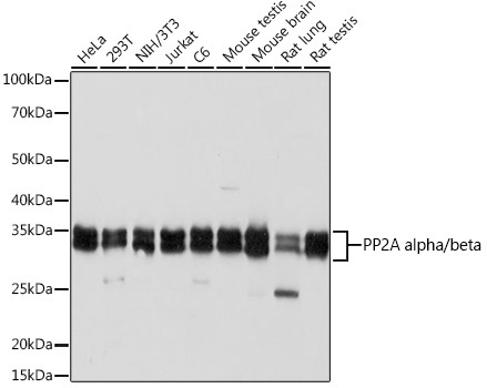 PP2A alpha + beta Rabbit Monoclonal Antibody