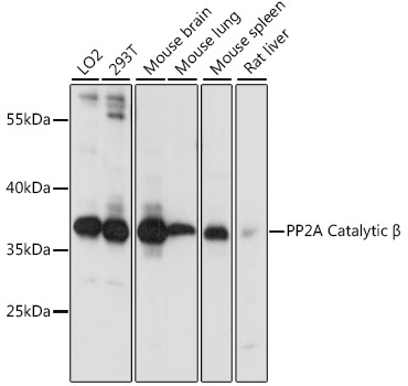 PP2A Catalytic Beta Rabbit Polyclonal Antibody
