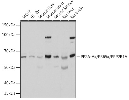 PP2A-AAlpha/PR65Alpha/PPP2R1A Rabbit Polyclonal Antibody