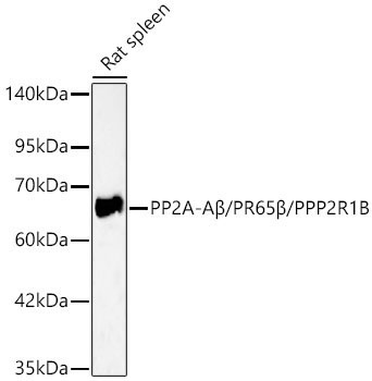 PP2A-ABeta/PR65Beta/PPP2R1B Rabbit Polyclonal Antibody