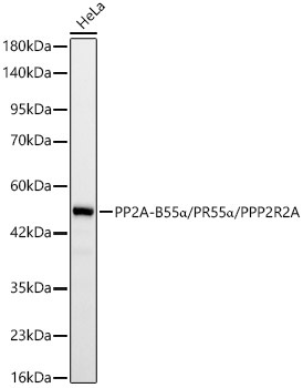 PP2A-B55Alpha/PR55Alpha/PPP2R2A Rabbit Monoclonal Antibody