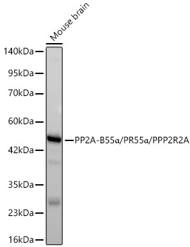 PP2A-B55Alpha/PR55Alpha/PPP2R2A Rabbit Monoclonal Antibody - Image 2