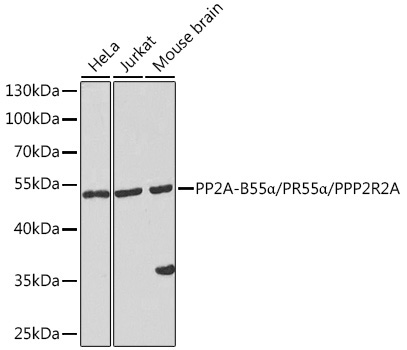 PP2A-B55Alpha/PR55Alpha/PPP2R2A Rabbit Polyclonal Antibody