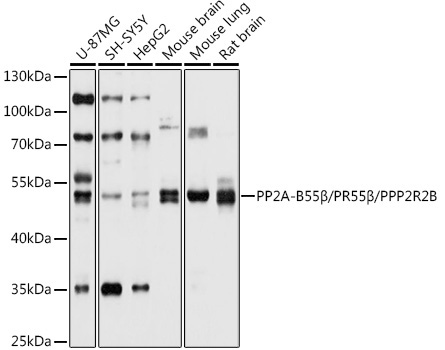 PP2A-B55Beta/PR55Beta/PPP2R2B Rabbit Polyclonal Antibody