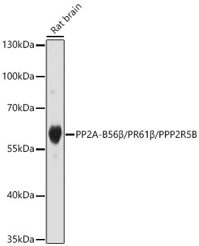 PP2A-B56Beta/PR61Beta/PPP2R5B Rabbit Polyclonal Antibody