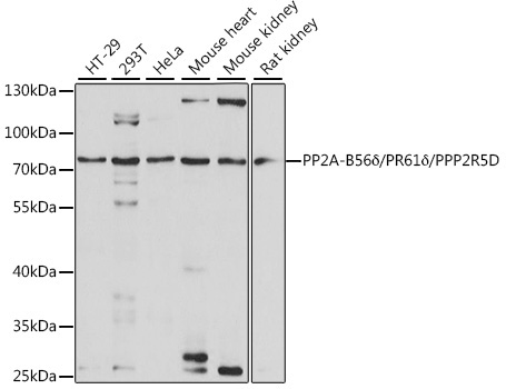 PP2A-B56Delta/PR61Delta/PPP2R5D Rabbit Polyclonal Antibody