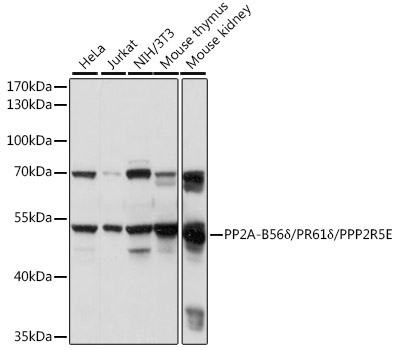 PP2A-B56Delta/PR61Delta/PPP2R5E Rabbit Polyclonal Antibody