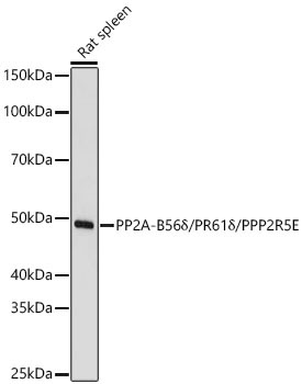 PP2A-B56Delta/PR61Delta/PPP2R5E Rabbit Polyclonal Antibody