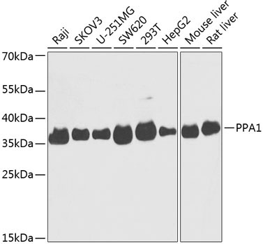 PPA1 Rabbit Polyclonal Antibody