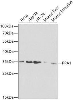 PPA1 Rabbit Polyclonal Antibody