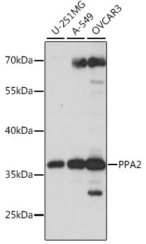 PPA2 Rabbit Polyclonal Antibody