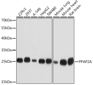 PPAP2A Rabbit Polyclonal Antibody