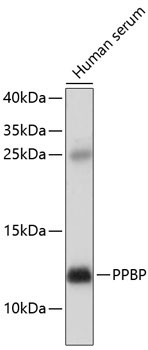 PPBP Rabbit Polyclonal Antibody