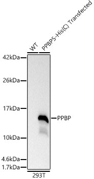 PPBP Rabbit Polyclonal Antibody
