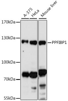 PPFIBP1 Rabbit Polyclonal Antibody