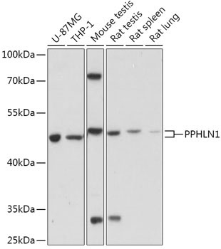 PPHLN1 Rabbit Polyclonal Antibody