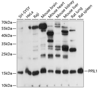 PPIL1 Rabbit Polyclonal Antibody
