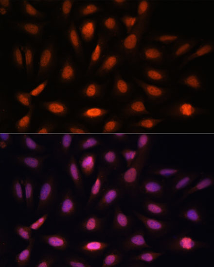 PPIL4 Rabbit Polyclonal Antibody - Image 2