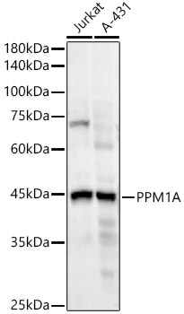 PPM1A Rabbit Monoclonal Antibody