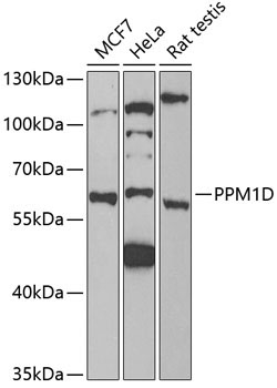 PPM1D Rabbit Polyclonal Antibody