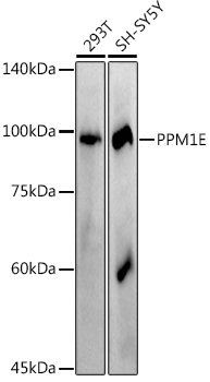 PPM1E Rabbit Monoclonal Antibody