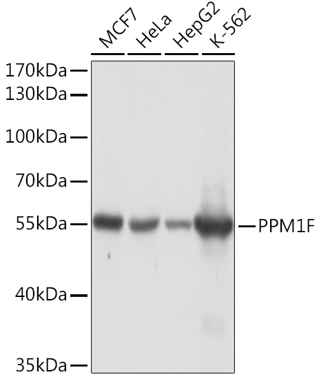 PPM1F Rabbit Polyclonal Antibody