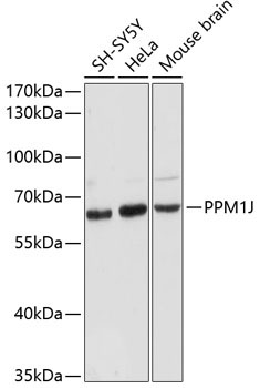 PPM1J Rabbit Polyclonal Antibody