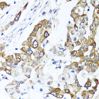 PPOX Rabbit Polyclonal Antibody - Image 2