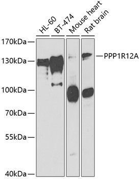 PPP1R12A Rabbit Polyclonal Antibody