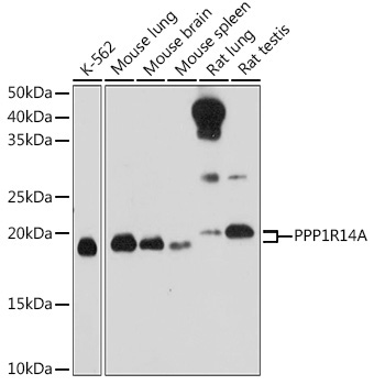 PPP1R14A Rabbit Polyclonal Antibody