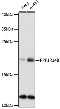 PPP1R14B Rabbit Polyclonal Antibody