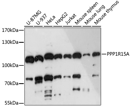 PPP1R15A Rabbit Polyclonal Antibody