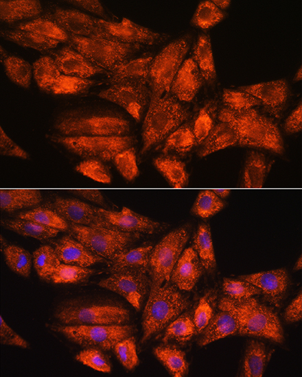 PPP1R15A Rabbit Polyclonal Antibody - Image 2