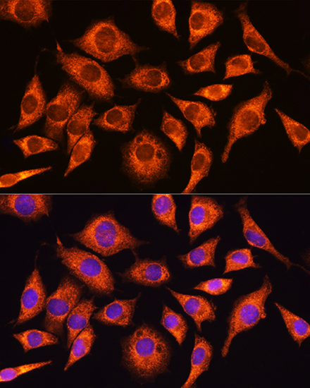 PPP1R15A Rabbit Polyclonal Antibody - Image 3