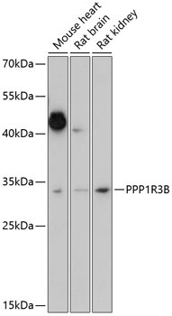 PPP1R3B Rabbit Polyclonal Antibody